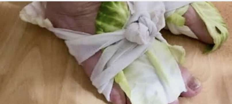 Cabbage Wraps: A Simple Remedy for Swollen Joints and Thyroid Issues