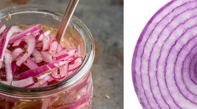 Unbelievable!  Red Onion: The Varicose Vein Killer! Erases Varicose Veins Like an Eraser!