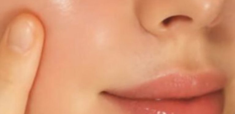 Vaselines magic recipe for removing wrinkles at any age even after the age of seventy